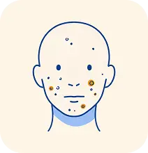 Skin Conditions