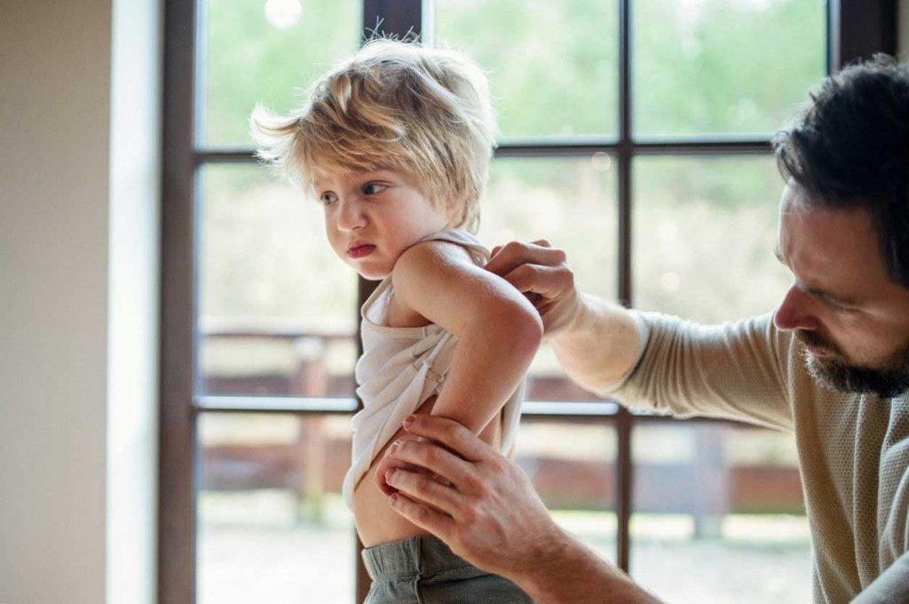 Chickenpox and shingles